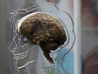 Video: Do we only use 10 percent of our brains?