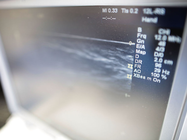 Critics jump on ultrasound and autism connection