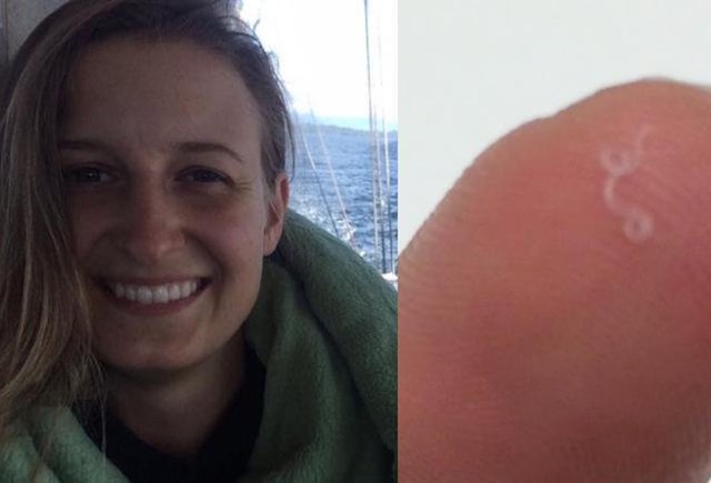 Worm in woman's eye leads to unique discovery