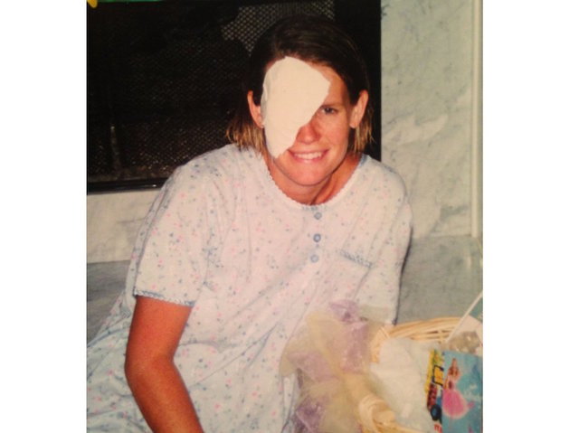 50 people near two cities have rare eye cancer; researchers are stumped