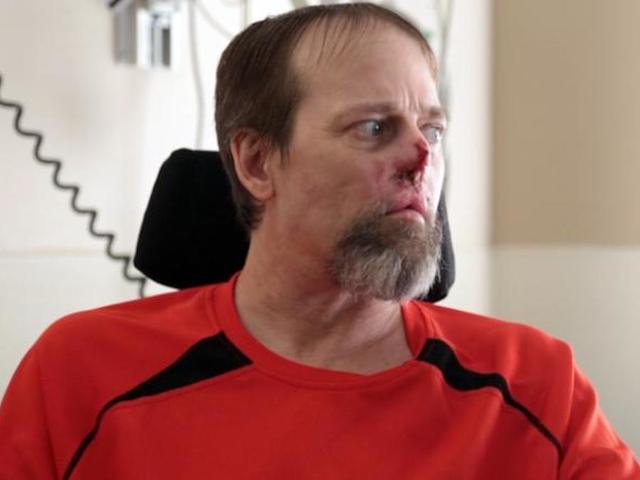 Man loses hands and feet after dog-related infection