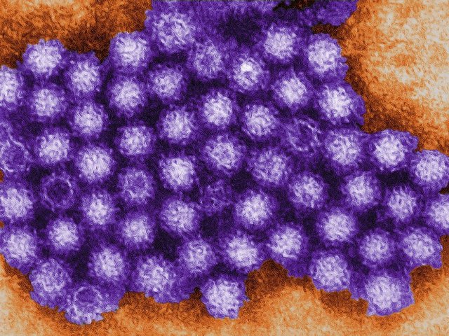 Norovirus strikes shelters for California wildfire evacuees